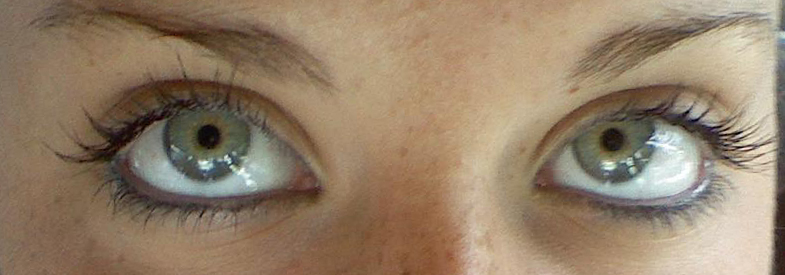 CMT Eyes